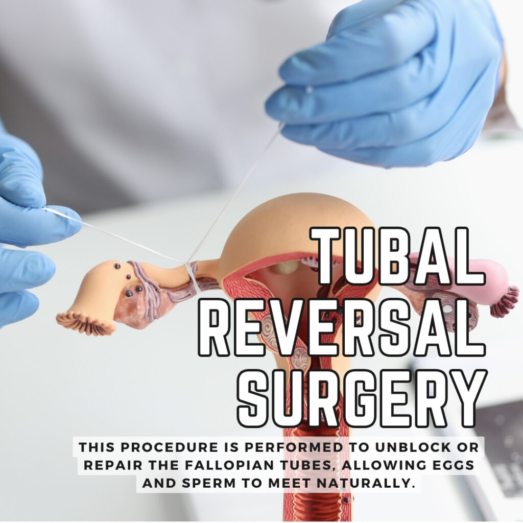 TUBAL-REVERSAL